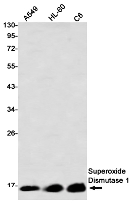 Superoxide Dismutase 1 Rabbit mAb ABZ2712