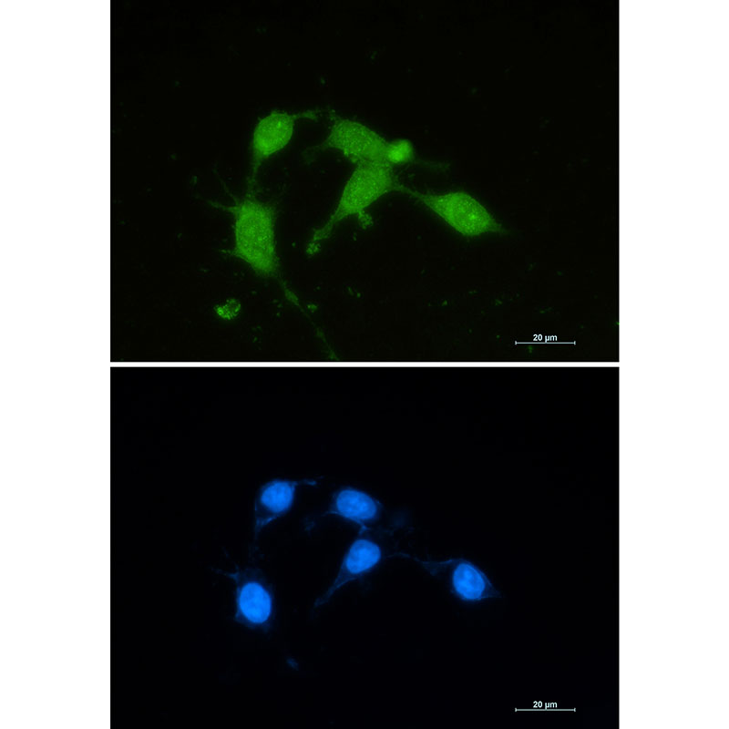 Superoxide Dismutase 1 Rabbit mAb ABZ2713