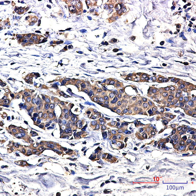 Superoxide Dismutase 1 Rabbit mAb ABZ2713
