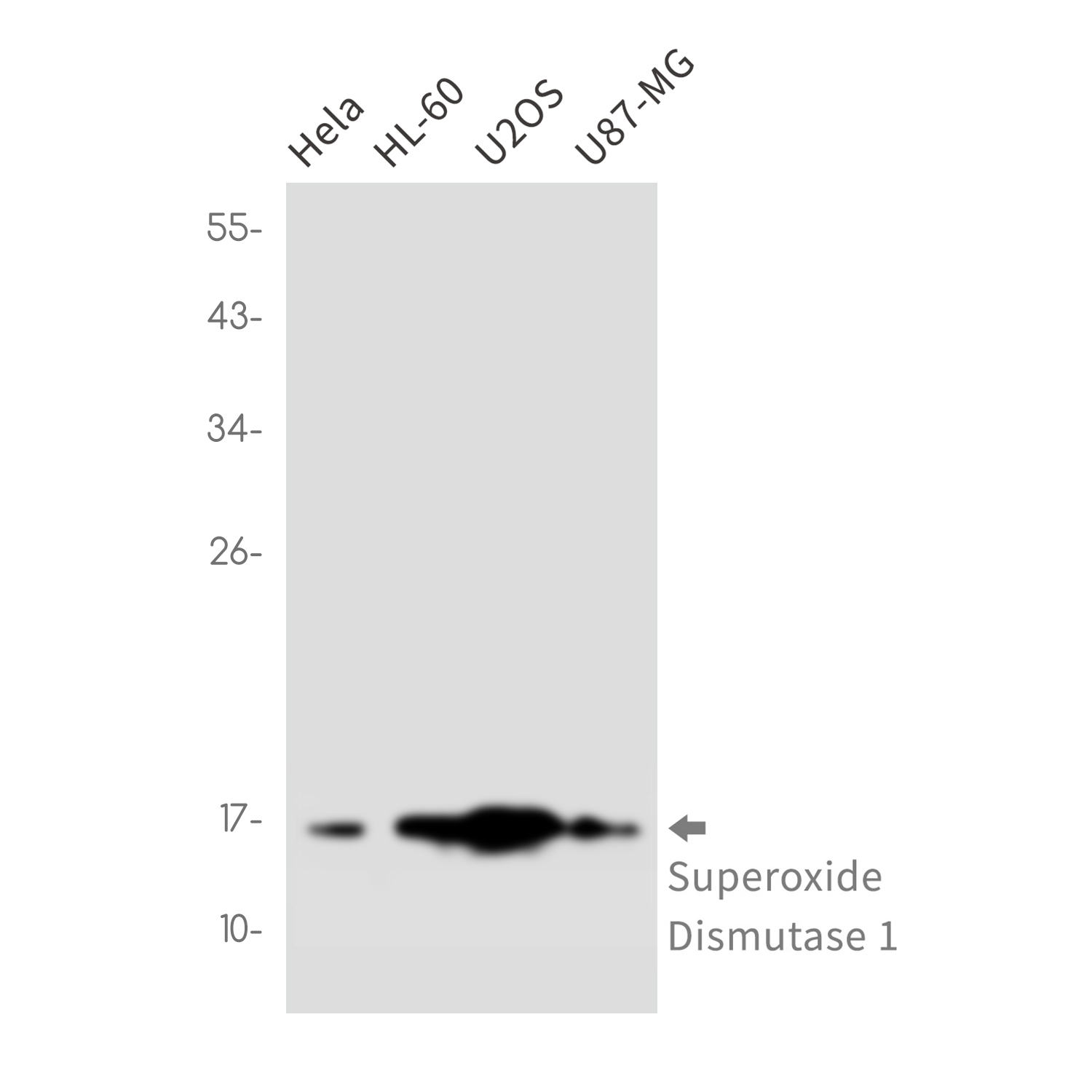 Superoxide Dismutase 1 Rabbit mAb ABZ2713