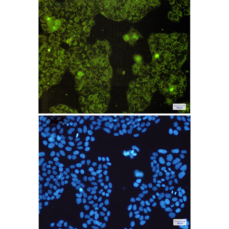 MTCO2 Rabbit mAb ABZ2714