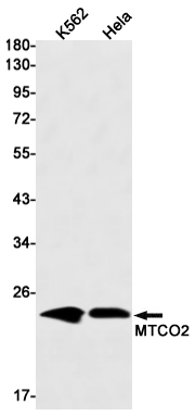 MTCO2 Rabbit mAb ABZ2714