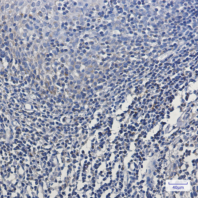 MTCO2 Rabbit mAb ABZ2715