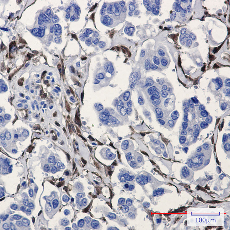 ALDH1A1 Rabbit mAb ABZ2718