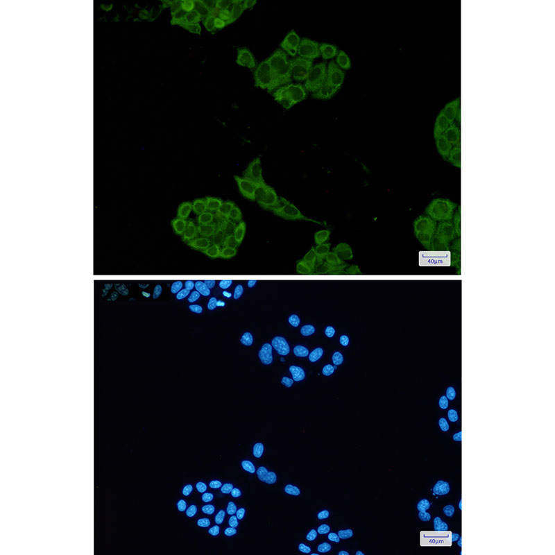 Lactate Dehydrogenase A Rabbit mAb ABZ2720