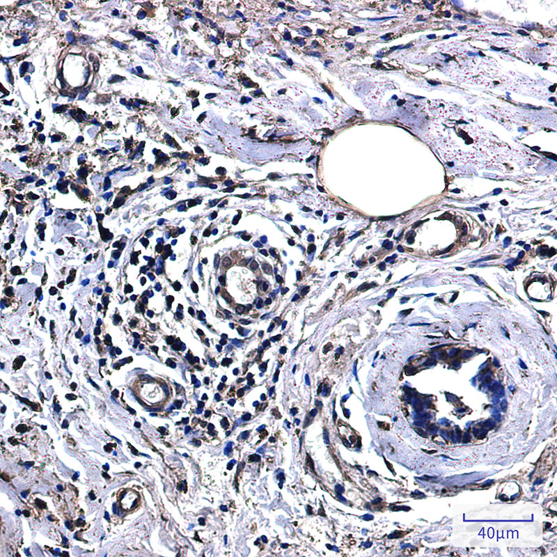 Lactate Dehydrogenase A Rabbit mAb ABZ2720