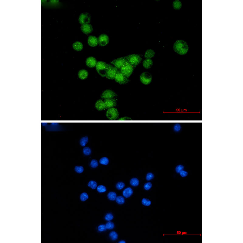 Cyclin E2 Rabbit mAb ABZ2721