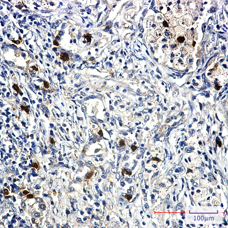 Cyclin E2 Rabbit mAb ABZ2721