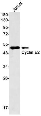Cyclin E2 Rabbit mAb ABZ2721