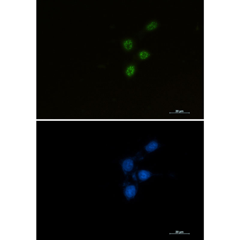 Chk2 Rabbit mAb ABZ2722