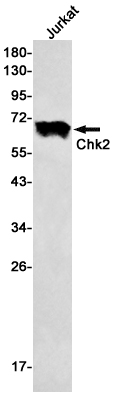 Chk2 Rabbit mAb ABZ2722