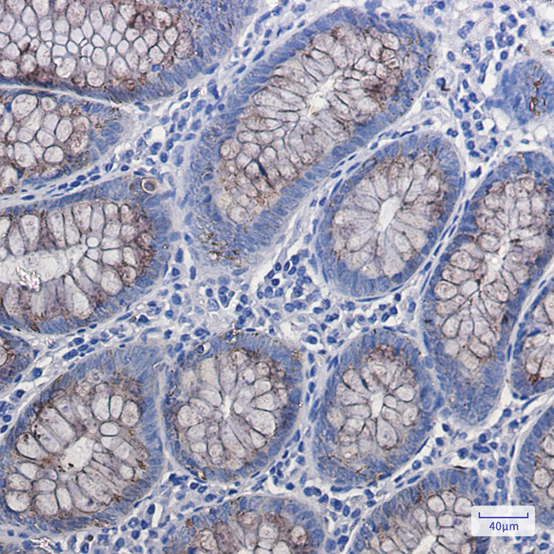 Anterior Gradient 2 Rabbit mAb ABZ2724
