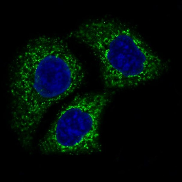 AIF Rabbit mAb ABZ2725