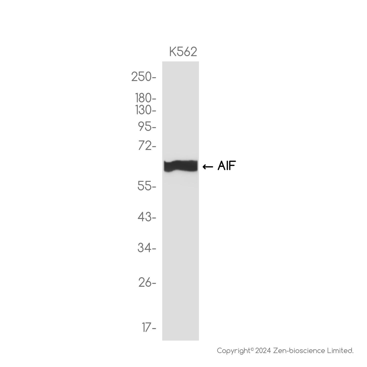 AIF Rabbit mAb ABZ2725