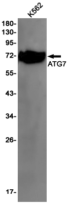 ATG7 Rabbit mAb ABZ2729