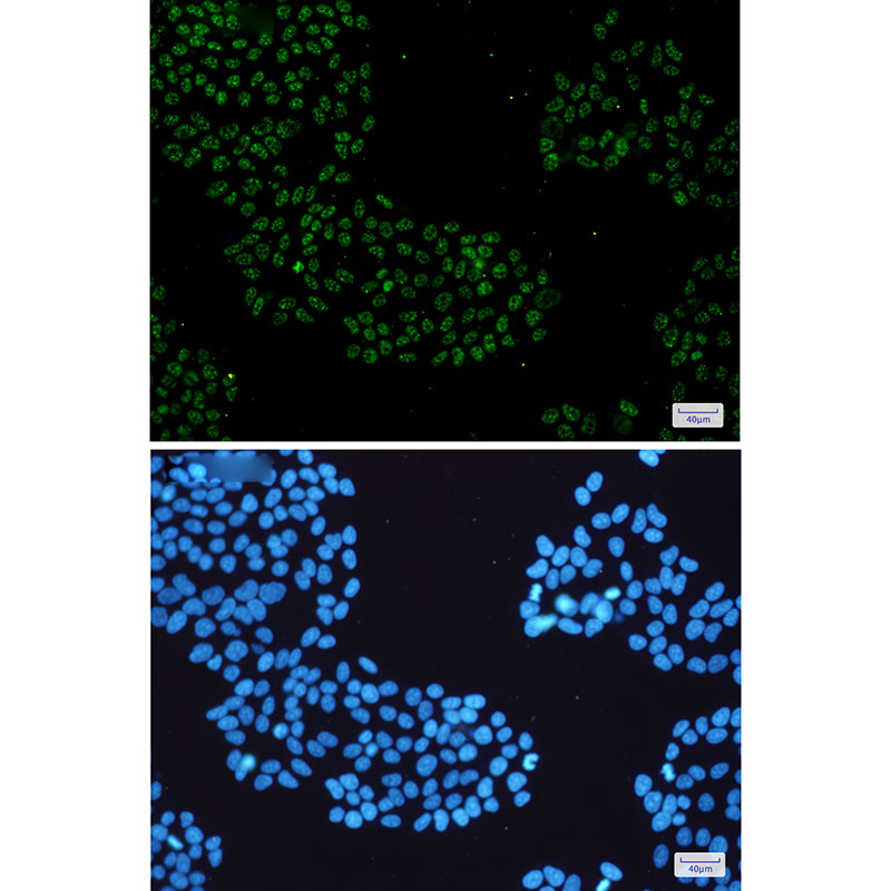 KDM4B / JMJD2B Rabbit mAb ABZ2732