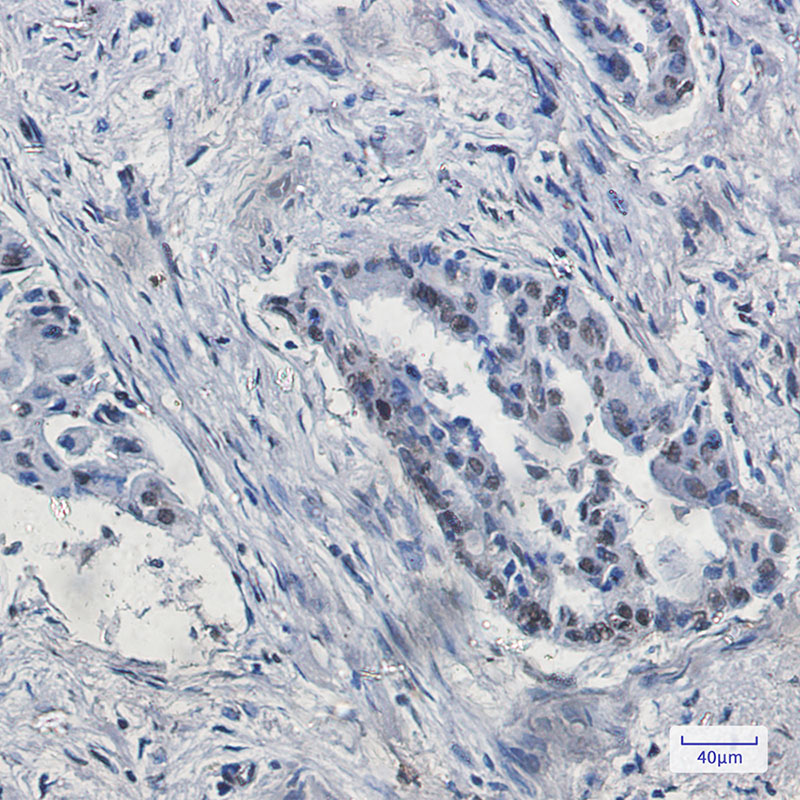 KDM4B / JMJD2B Rabbit mAb ABZ2732