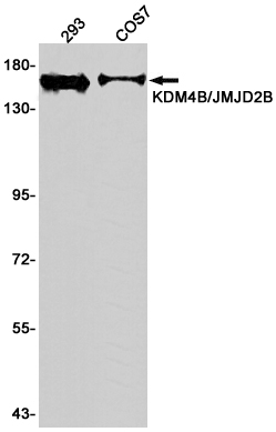 KDM4B / JMJD2B Rabbit mAb ABZ2732