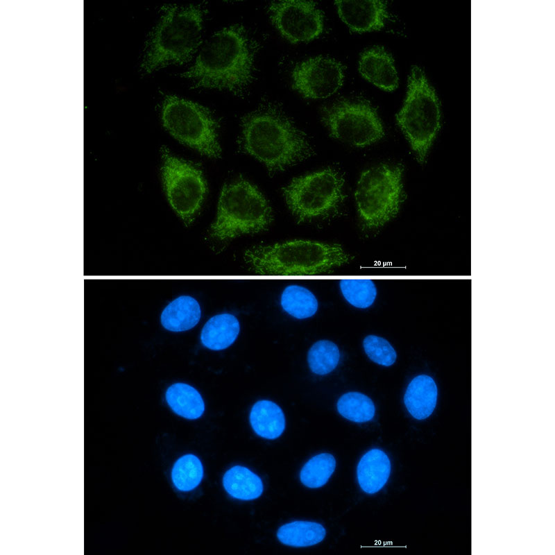 Glutaminase Rabbit mAb ABZ2733