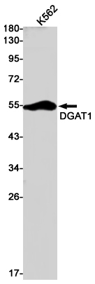 DGAT1 Rabbit mAb ABZ2738