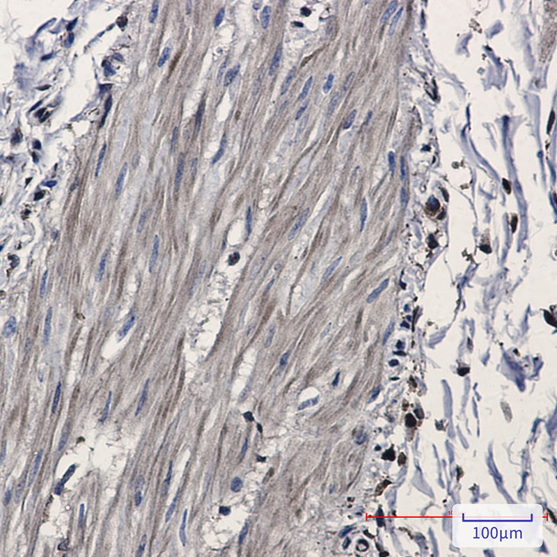 IDH1 Rabbit mAb ABZ2740