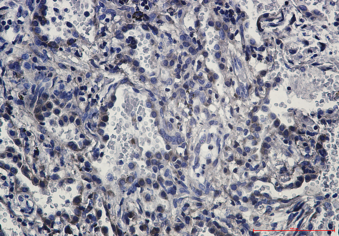 Fas Rabbit mAb ABZ2742