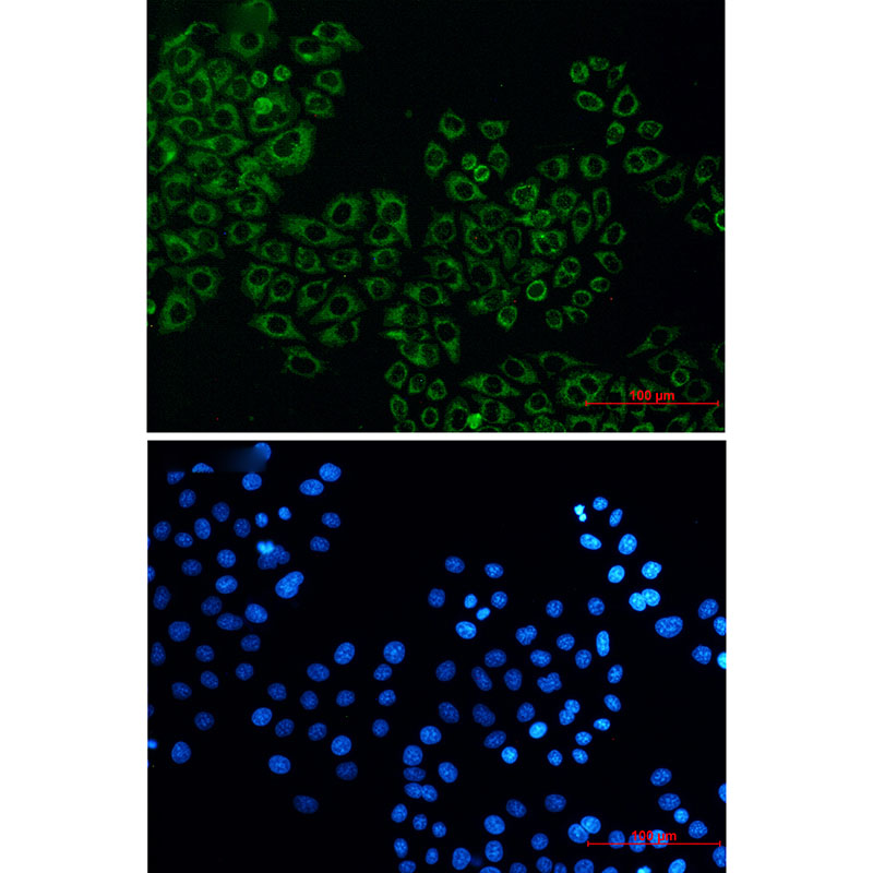 Citrate Synthetase Rabbit mAb ABZ2743