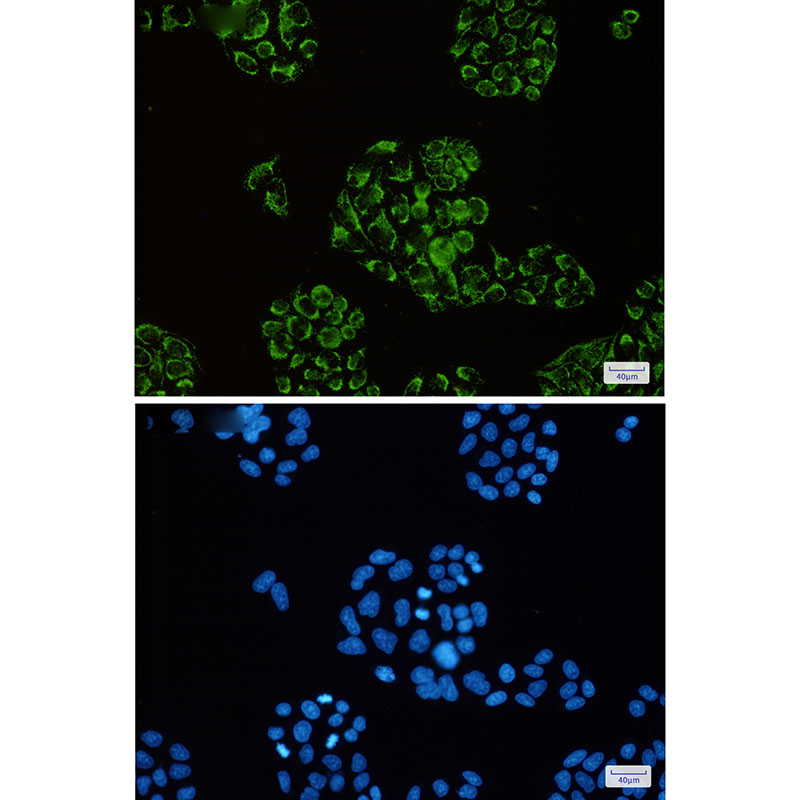 Citrate Synthetase Rabbit mAb ABZ2744