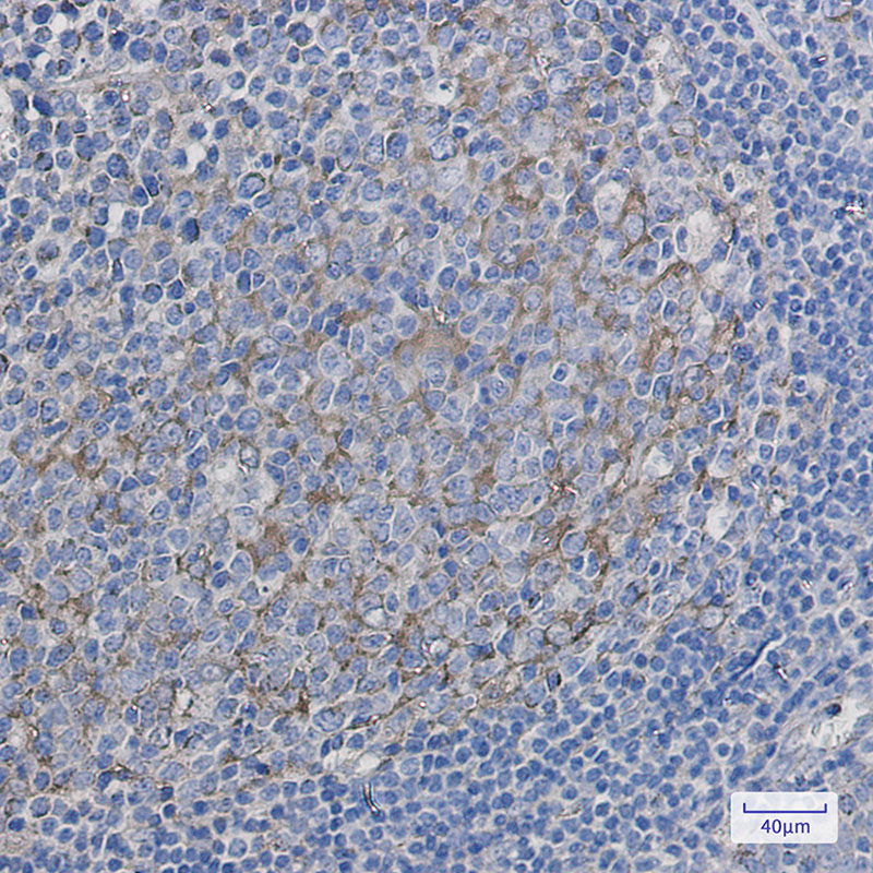 Citrate Synthetase Rabbit mAb ABZ2744