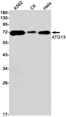 KIAA0652/ATG13 Rabbit mAb ABZ2745