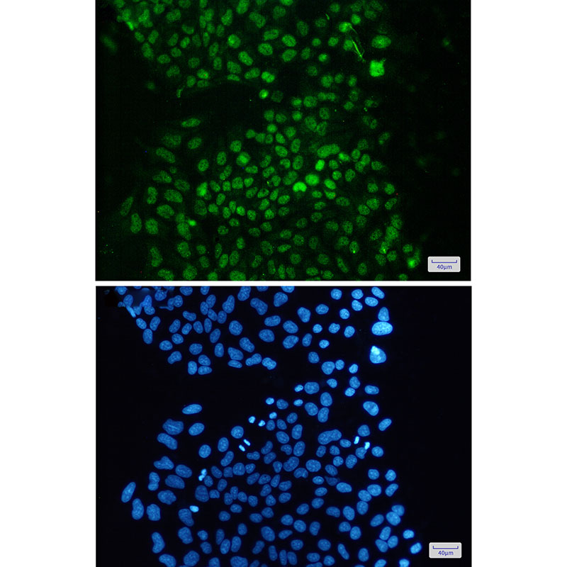 KDM1/LSD1 Rabbit mAb ABZ2749