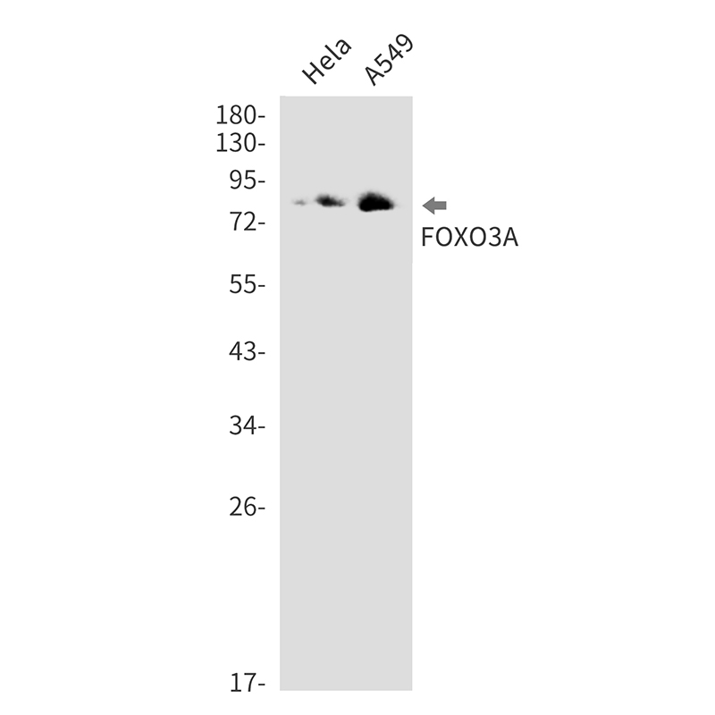 FOXO3A Rabbit mAb ABZ2750