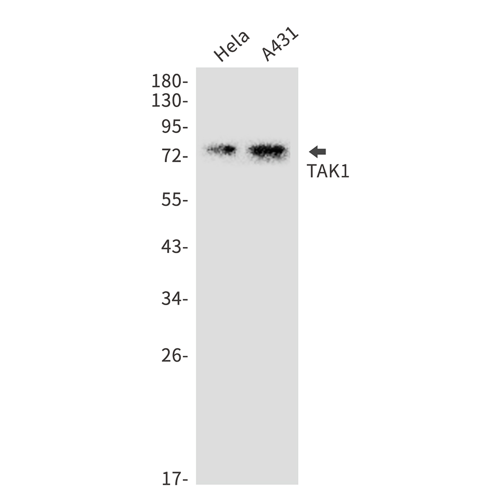 TAK1 Rabbit mAb ABZ2751