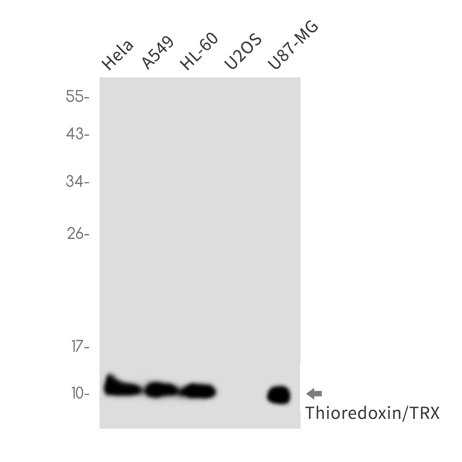 Thioredoxin / TRX Rabbit mAb ABZ2754