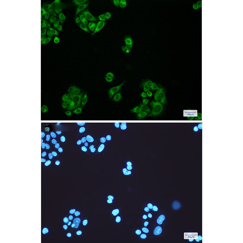 ELOVL5 Rabbit mAb ABZ2756