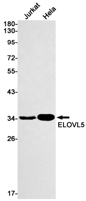 ELOVL5 Rabbit mAb ABZ2756