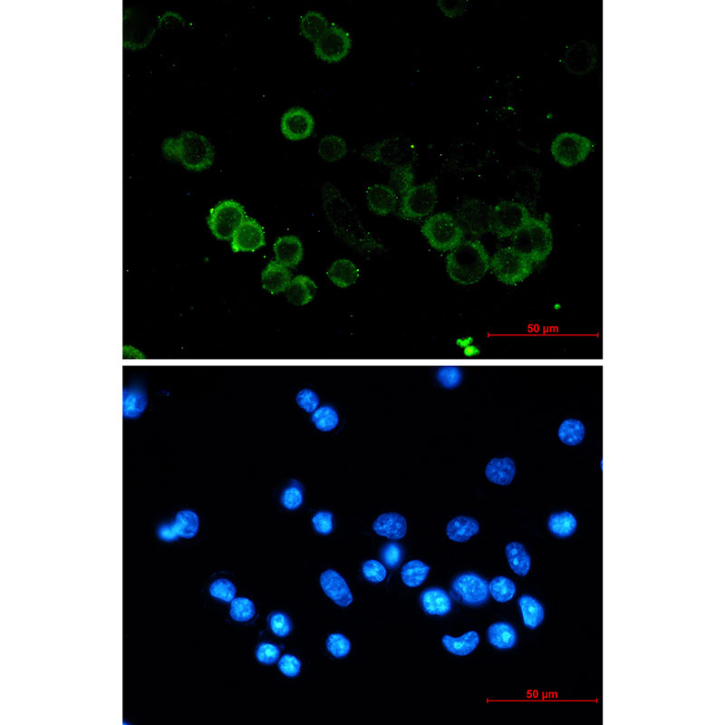 E Cadherin Rabbit mAb ABZ2758
