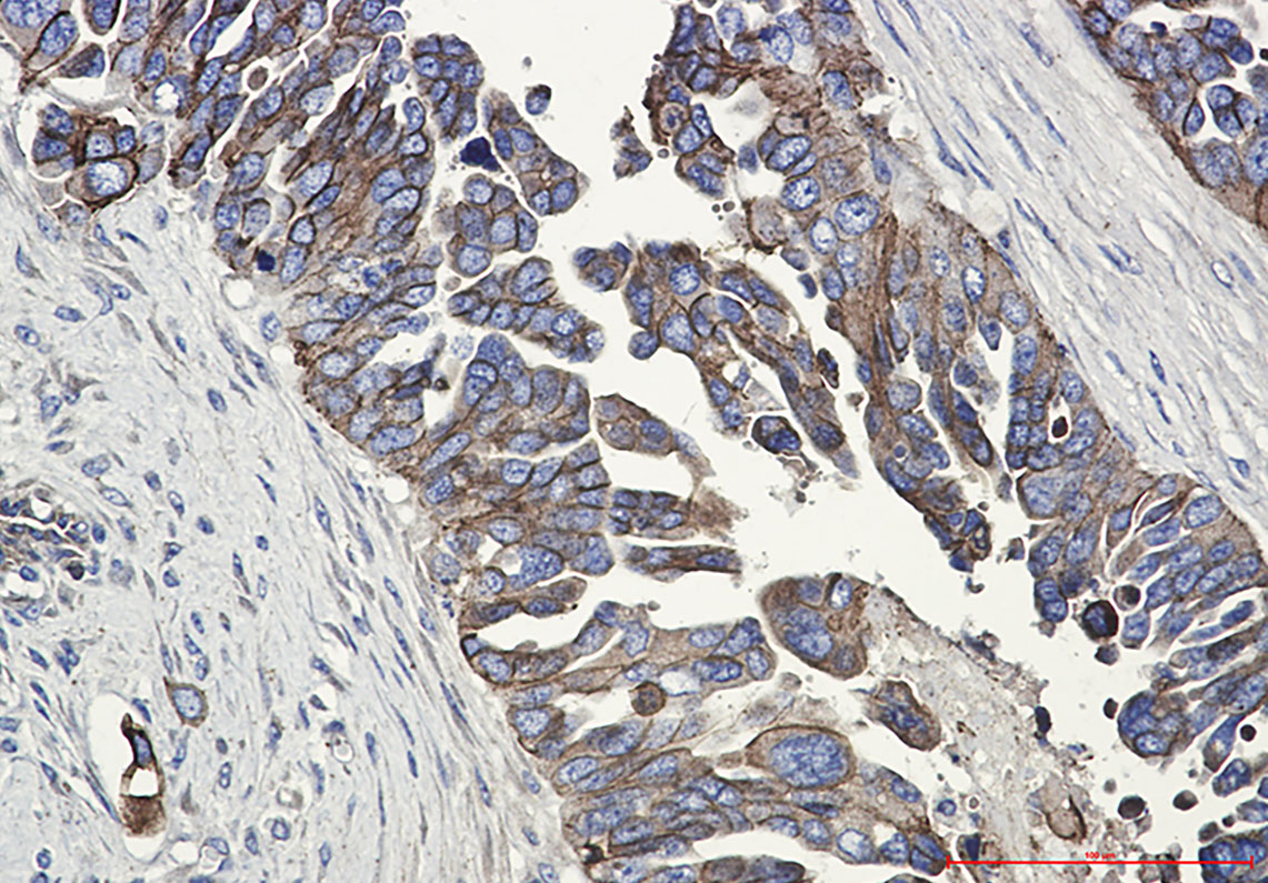 E Cadherin Rabbit mAb ABZ2758