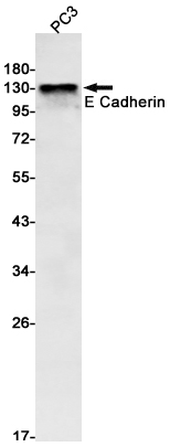 E Cadherin Rabbit mAb ABZ2758