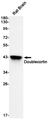 Doublecortin Rabbit mAb ABZ2759