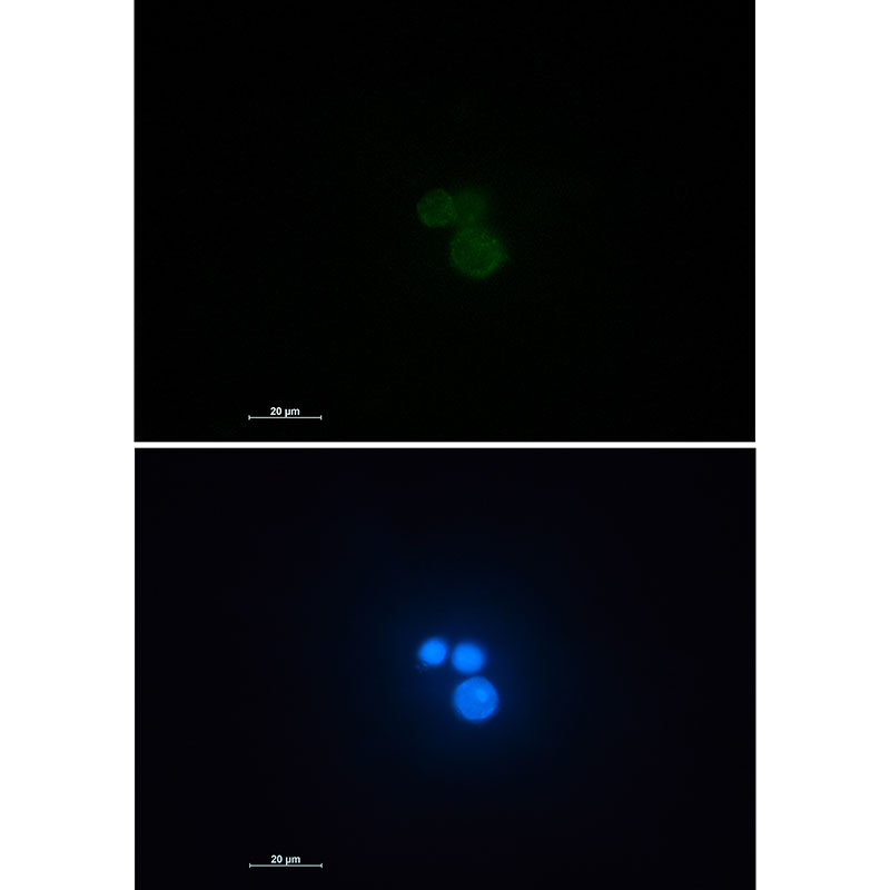 Matrin 3 Rabbit mAb ABZ2760