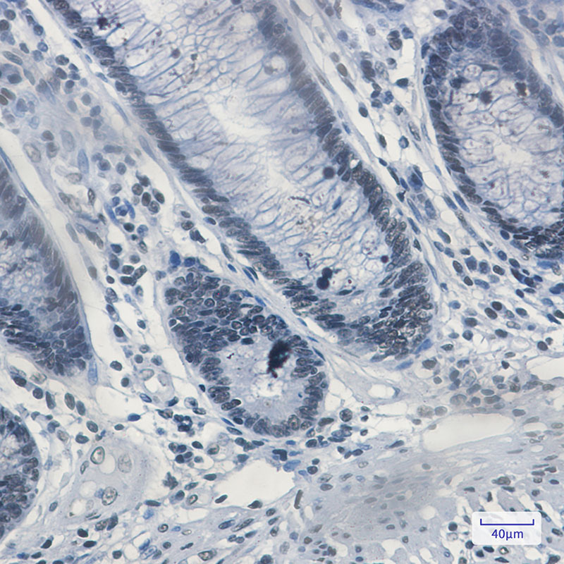 Matrin 3 Rabbit mAb ABZ2760
