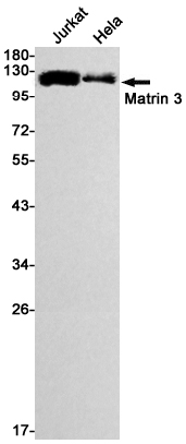 Matrin 3 Rabbit mAb ABZ2760