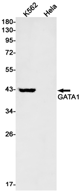 GATA1 Rabbit mAb ABZ2763