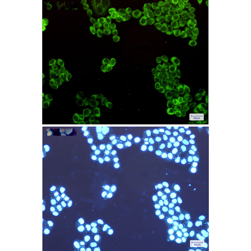 Tryptophanyl tRNA synthetase Rabbit mAb ABZ2765