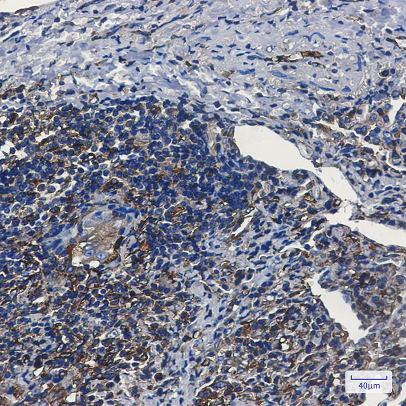 Tryptophanyl tRNA synthetase Rabbit mAb ABZ2765