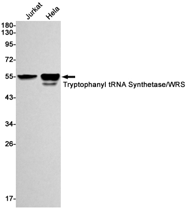 Tryptophanyl tRNA synthetase Rabbit mAb ABZ2765