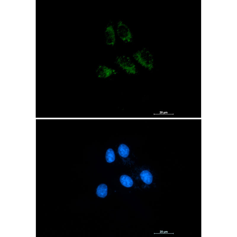 Thrombomodulin Rabbit mAb ABZ2767