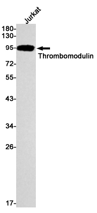 Thrombomodulin Rabbit mAb ABZ2767