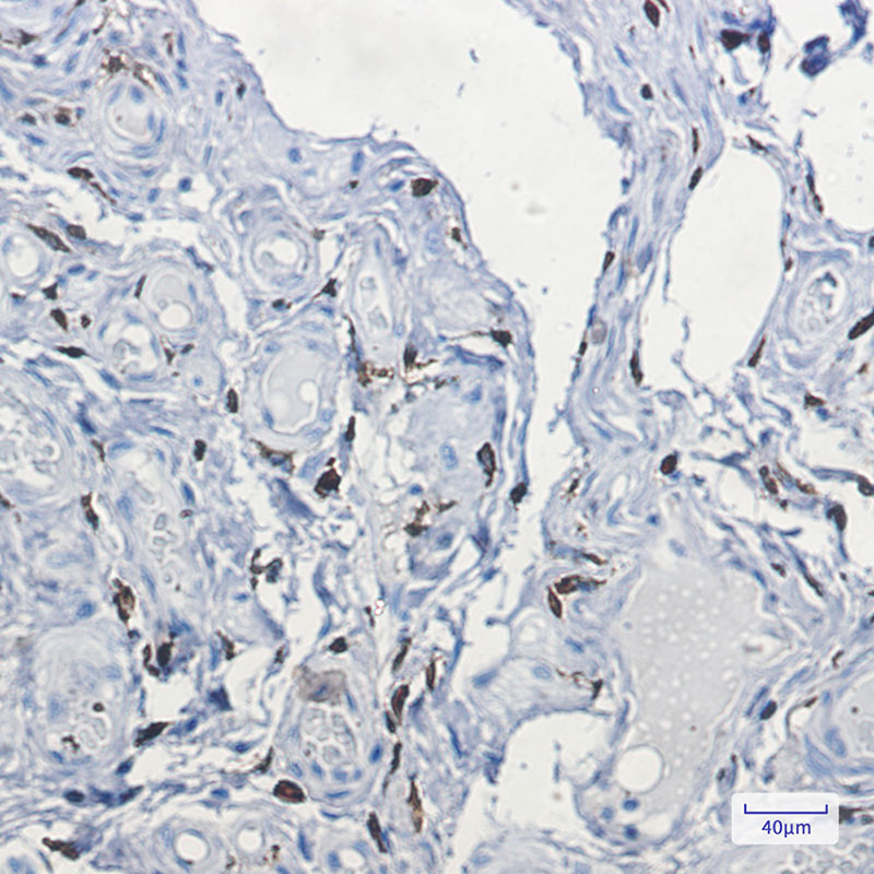 Factor XIIIa Rabbit mAb ABZ2769